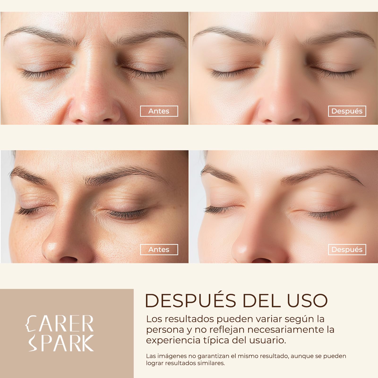 CARER SPARK Peeling Ultrasónico Facial – Espátula Facial Ultrasónica EMS e Iones y Terapia de Luz, 4 Modos para Limpieza Profunda Eliminación de Puntos Negros Exfoliación Suave Recargable USB