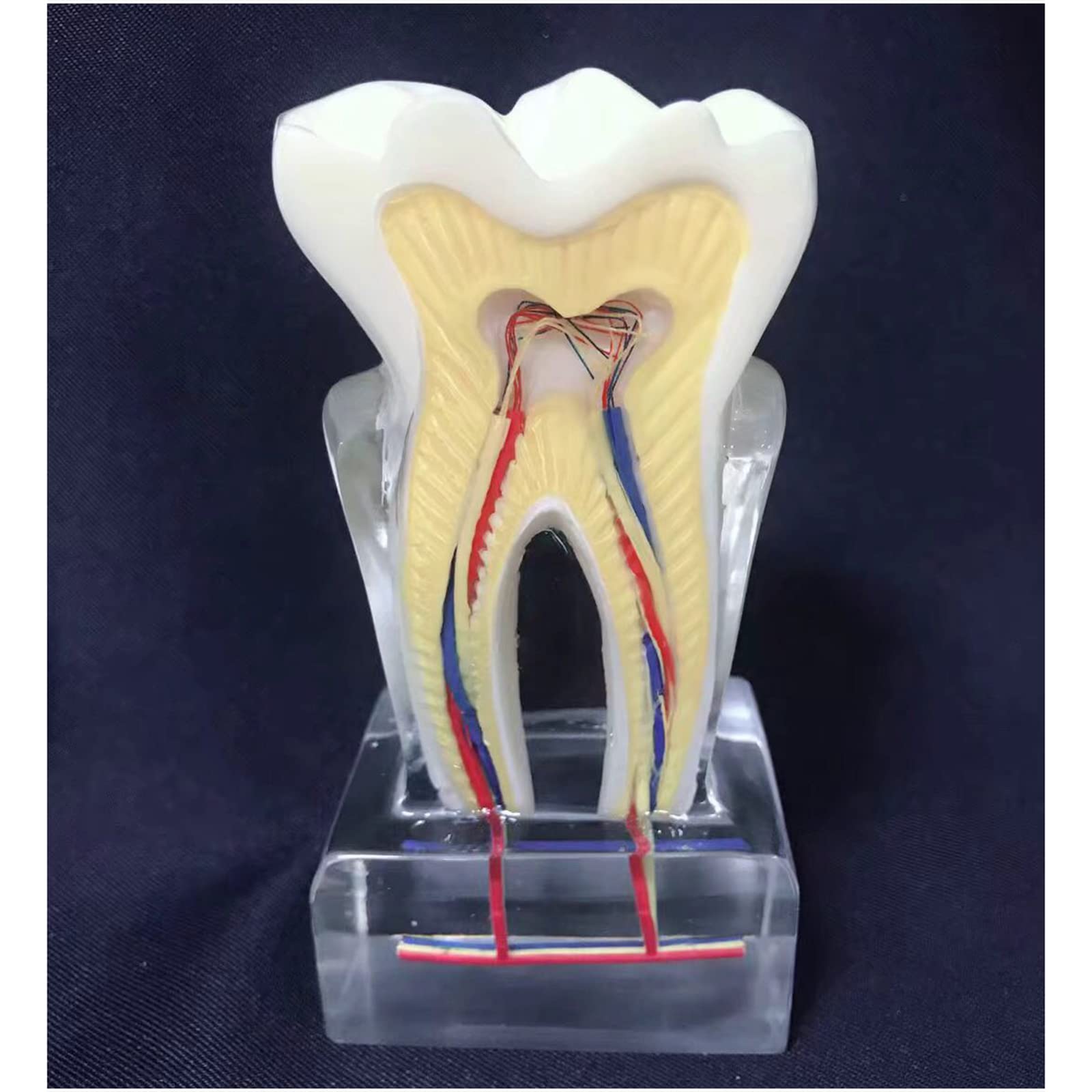 6 modèles de profil dentaire – Modèle d'étude – Modèle d'affichage dentaire – Modèle anatomique des dents – Instrument d'enseignement clair – Pour communication médecin-patient