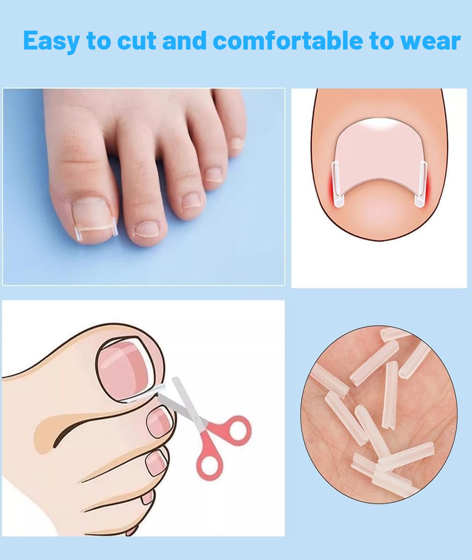 50 PCS Ingrown Toe Nail Remover, Toe Nail Corrector Kit, Ingrown Toenail Correction Tool for Home Foot Care, Includes Nail Clippers and Corrective Tools for Daily Nail Maintenance 3