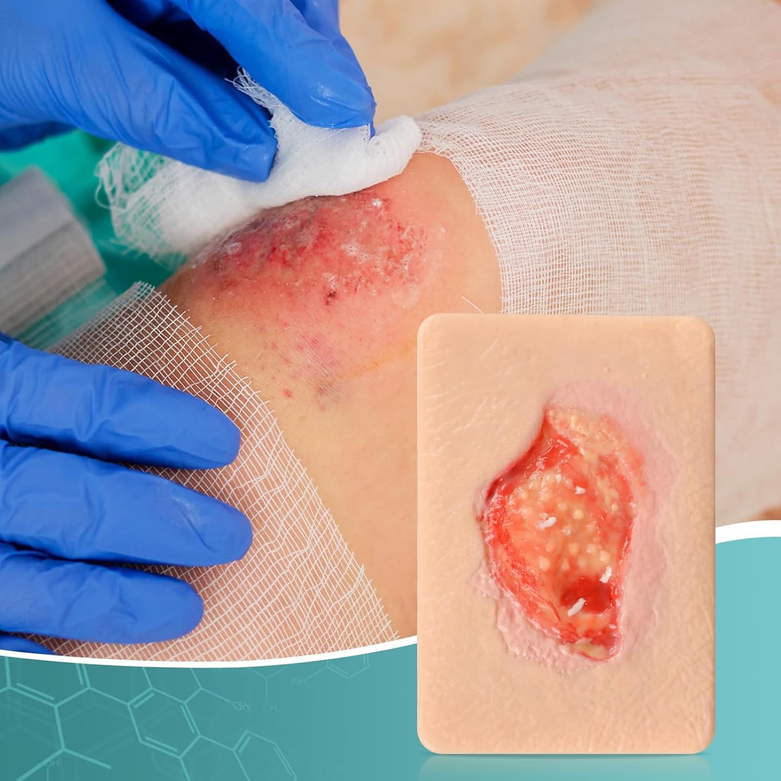 Dispositif De Simulation De Pansement par Granulation (3 Ou 4 Pièces), Modèle De Pansement De La Taille d'une Paume, pour La Formation Médicale Et Les Démonstrations De Soins des Plaies