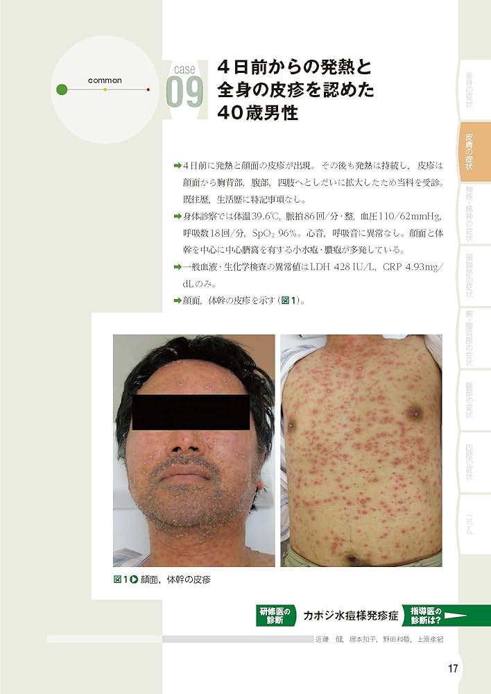 外来診療のUncommon Disease vol.3【電子版付】 : Amazon.sg: Books