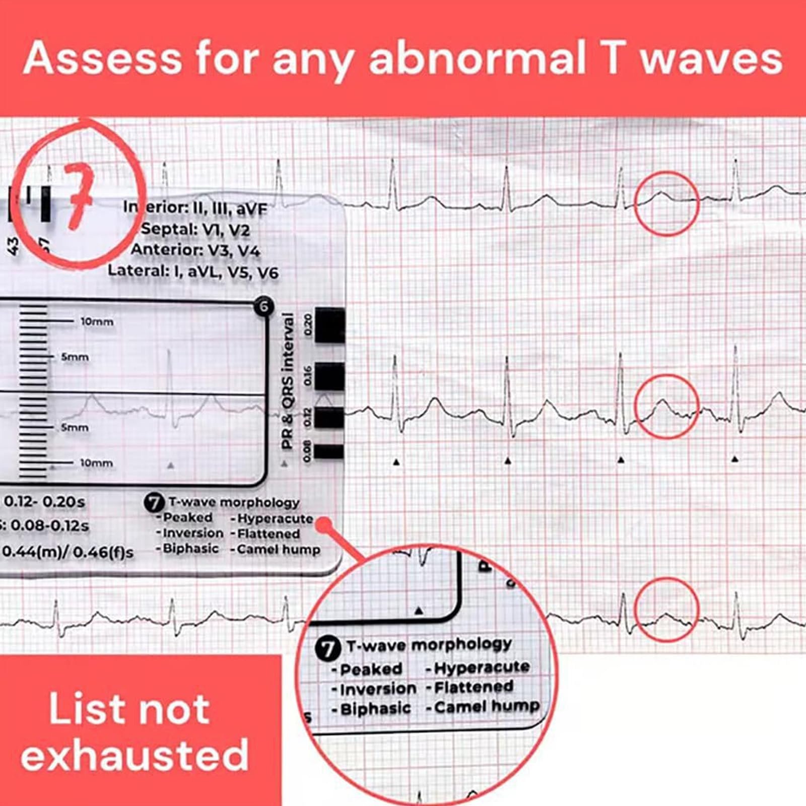 Électrocardiogramme 7 étapes Carte Règle pour une interprétation précise et une analyse rapide dans les paramètres médicaux Outil d'évaluation Moniteur cardiaque Aide