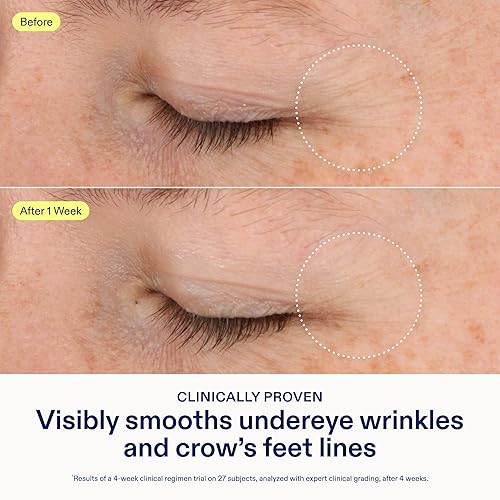 Miniatura 3 de Skinfix Triple Lipid-Boost 360 Eye - 0.5 onzas líquidas - Suaviza visiblemente las arrugas debajo de los ojos y las líneas de patas de gallo con