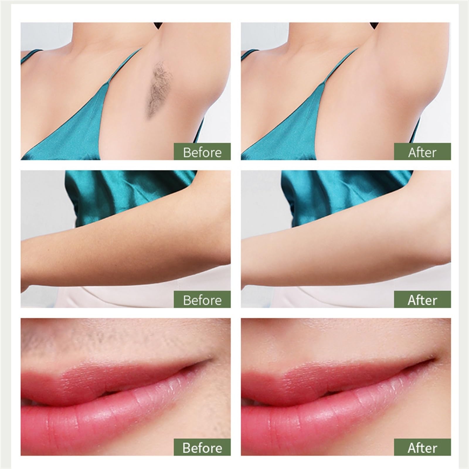 Depiladora láser, depiladora con luz pulsada de 5 Niveles de energía, Mujeres, Hombres, Axilas, Rostro, Cuerpo