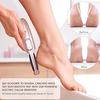Powerful Electric Foot Callus Remover Rechargeable