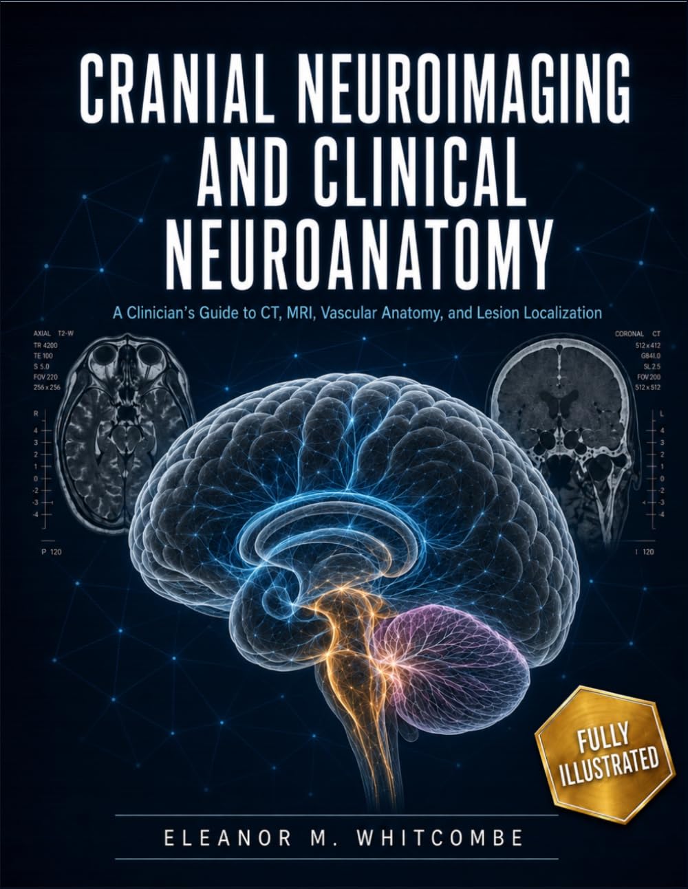 Cranial Neuroimaging And Clinical Neuroanatomy: A Practical Guide To CT, MRI, Vascular Anatomy, And Lesion Localization