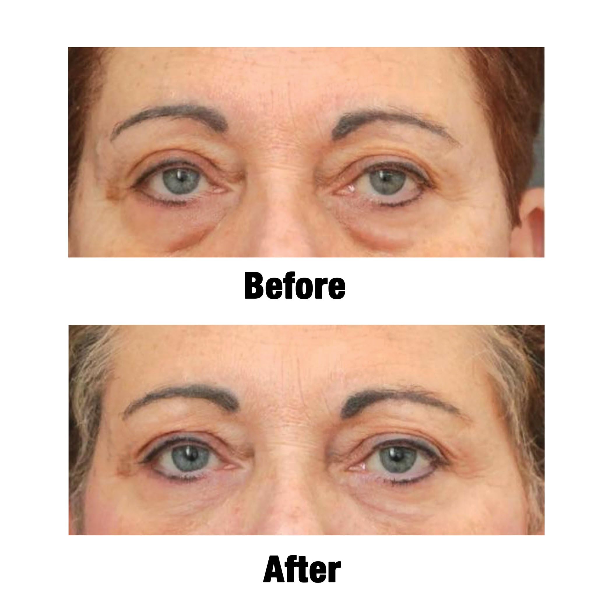 Collections Etc Non-Surgical Solutions Dark Circle Treatment Cream, 1 fl. oz.