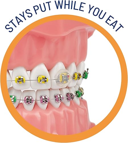 Miniatura 5 de Cera dental OrthoDots transparente, con humedad activada, de silicona, alternativa para el dolor causado por los aparatos de ortodoncia, se adhiere