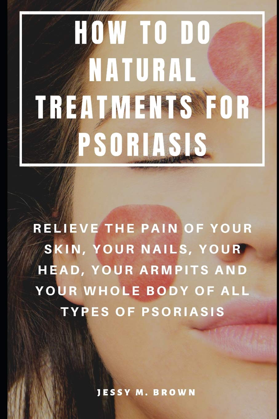 HOW TO DO NATURAL TREATMENTS FOR PSORIASIS : RELIEVE THE PAIN OF YOUR SKIN, YOUR NAILS, YOUR HEAD, YOUR ARMPITS AND YOUR WHOLE BODY OF ALL TYPES OF PSORIASIS