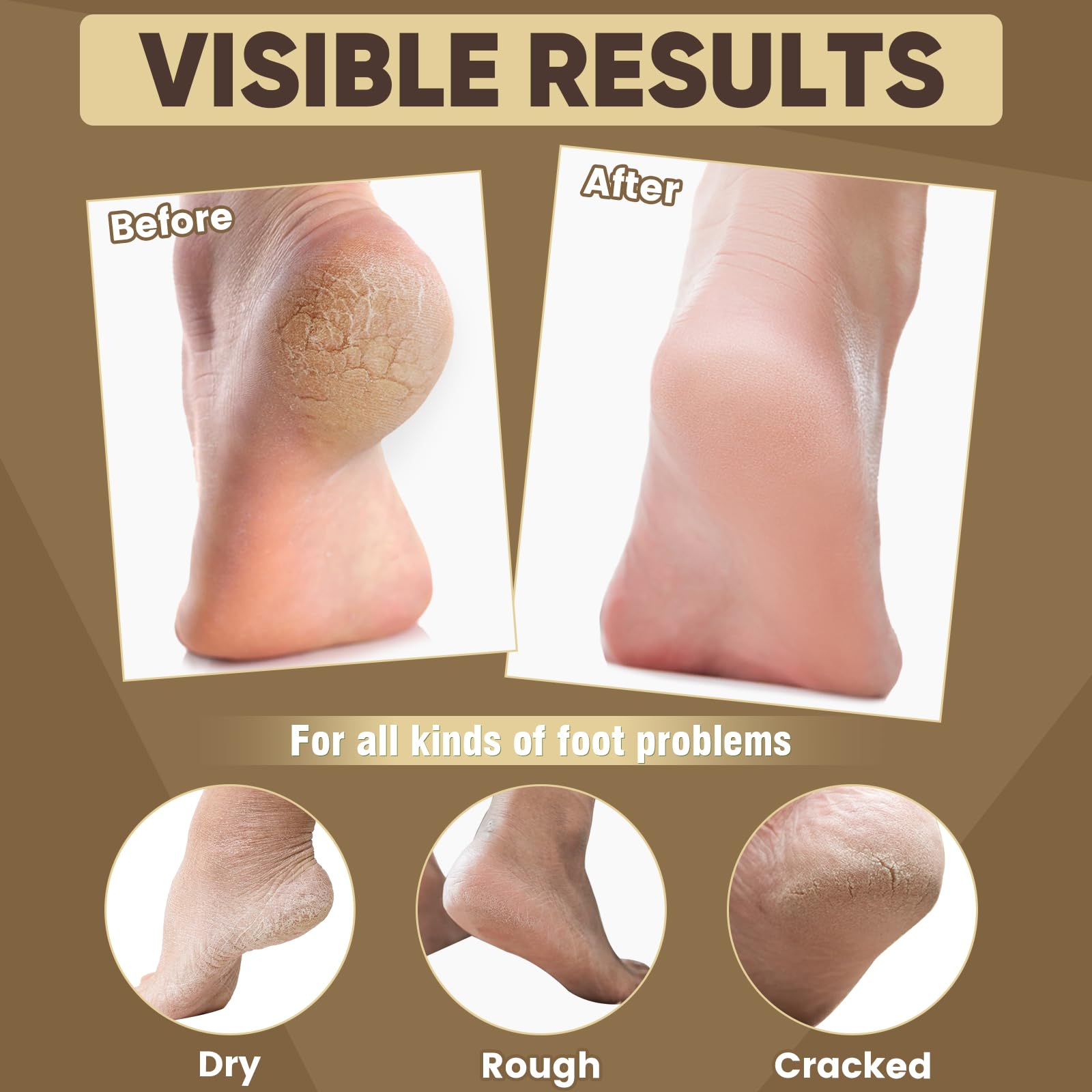 TEAWOO 6 Pairs Moisturizing Foot Masks with Shea Butter, Jojoba Oil, Vitamin E & Urea, 6 Pairs Intensely Hydrating Foot Mask For Dry Cracked Feet, Moisturizing Socks for Cracked Heel Treatment: 18 Pack Castor Oil