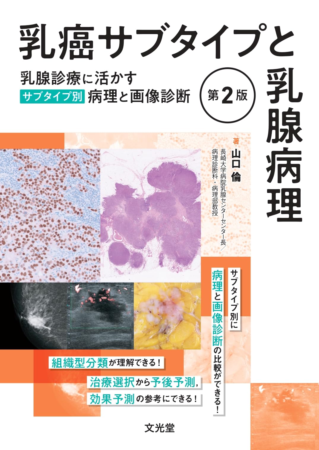 乳癌サブタイプと乳腺病理 第2版 乳腺診療に活かすサブタイプ別病理と