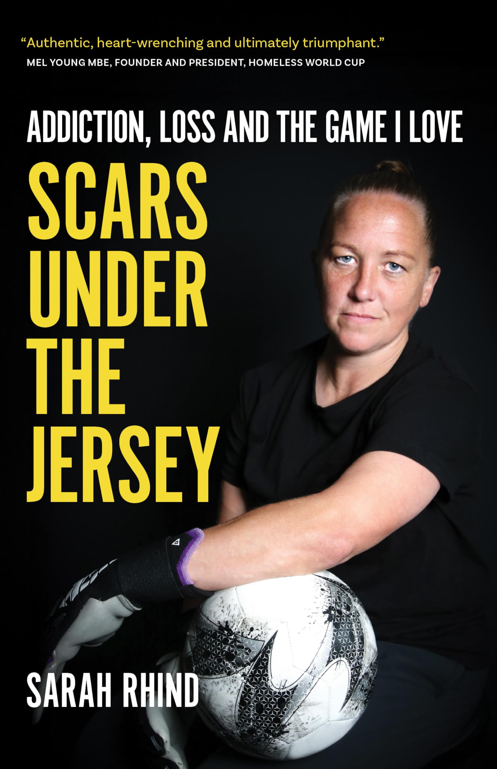 Scars Under the Jersey PAPERBACK 9781909430631