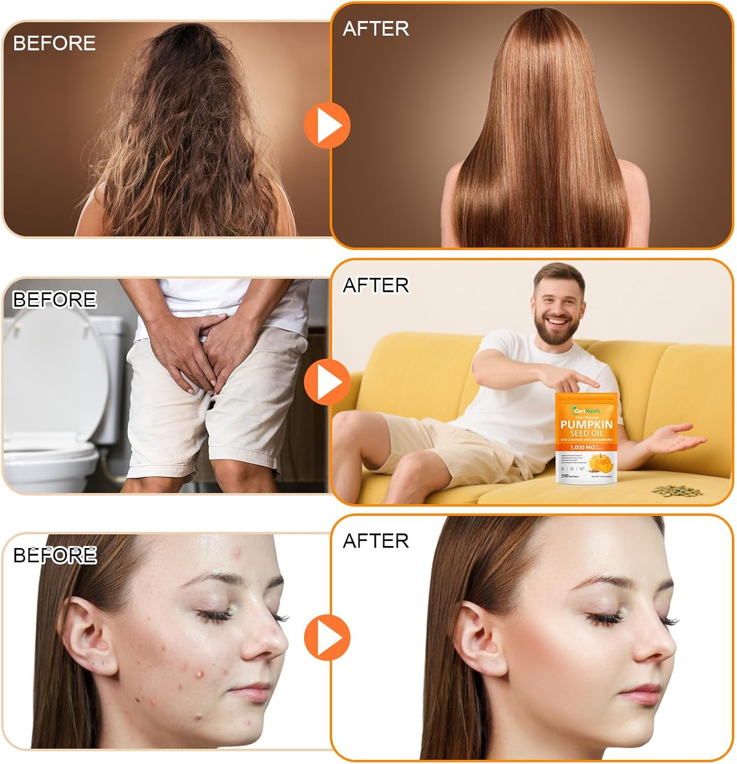 Pumpkin Seed Oil with Saw Palmetto (1000mg per Serving), Cold-Pressed Pumpkin Seed Oil for Hair Growth, Prostate Health, Urinary Tract Support, 300 Softgels Supplement of Essential Fatty Acids - Image 6