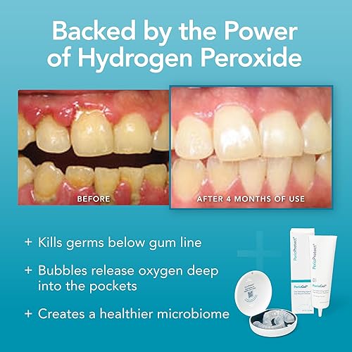 Miniatura 7 de Perio Gel | Tratamiento periodontal para dientes | Promueve el blanqueamiento dental (3 onzas)