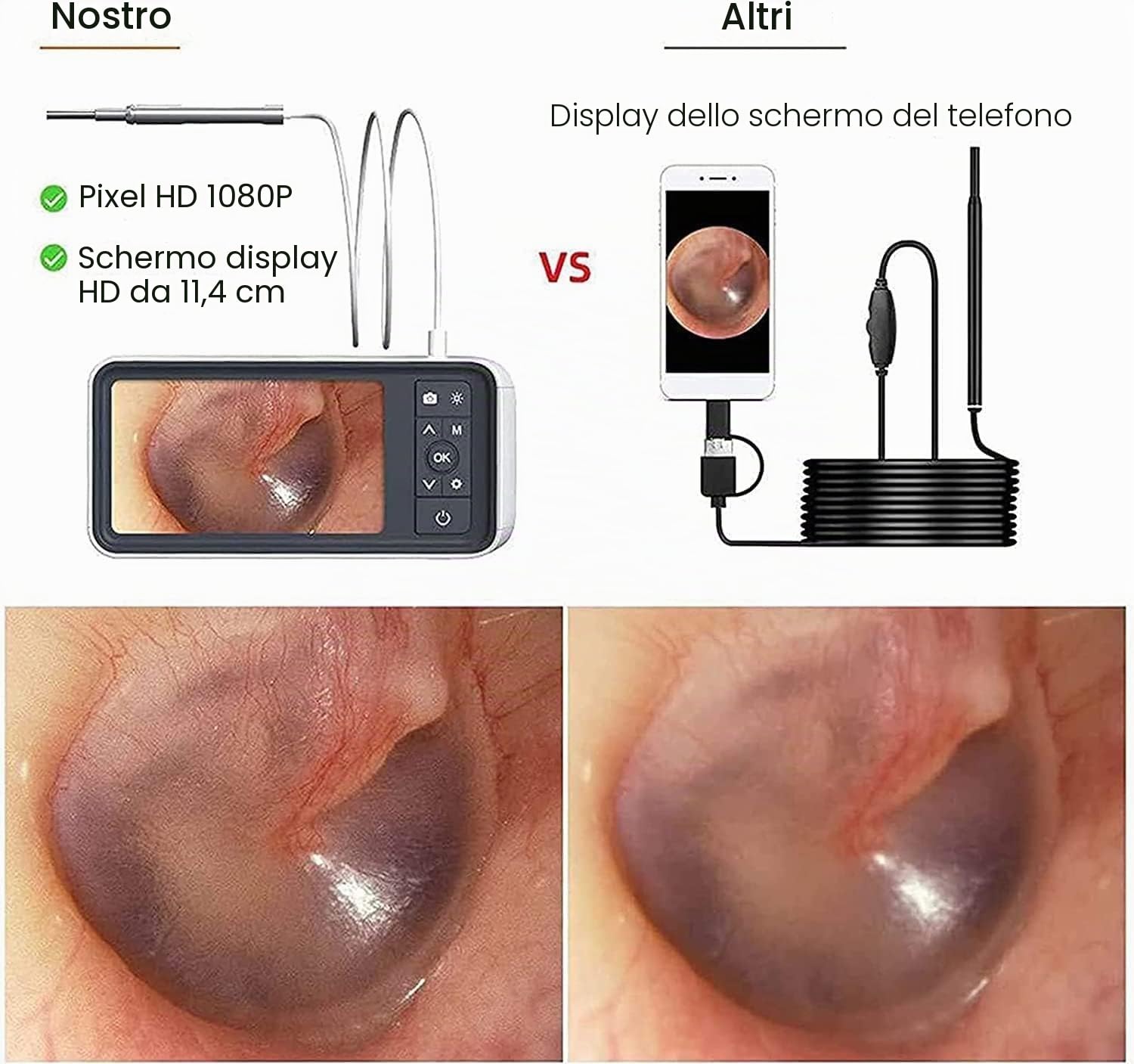 Otoscopio Digitale, Endoscopio per Esame del Canale Uditivo E Nasale, Obiettivo da 3.9 mm, Schermo da 4.5 Pollici, con 6 Luci LED, Adatto per Adulti, Bambini E Animali Domestici, gaoyun-1001