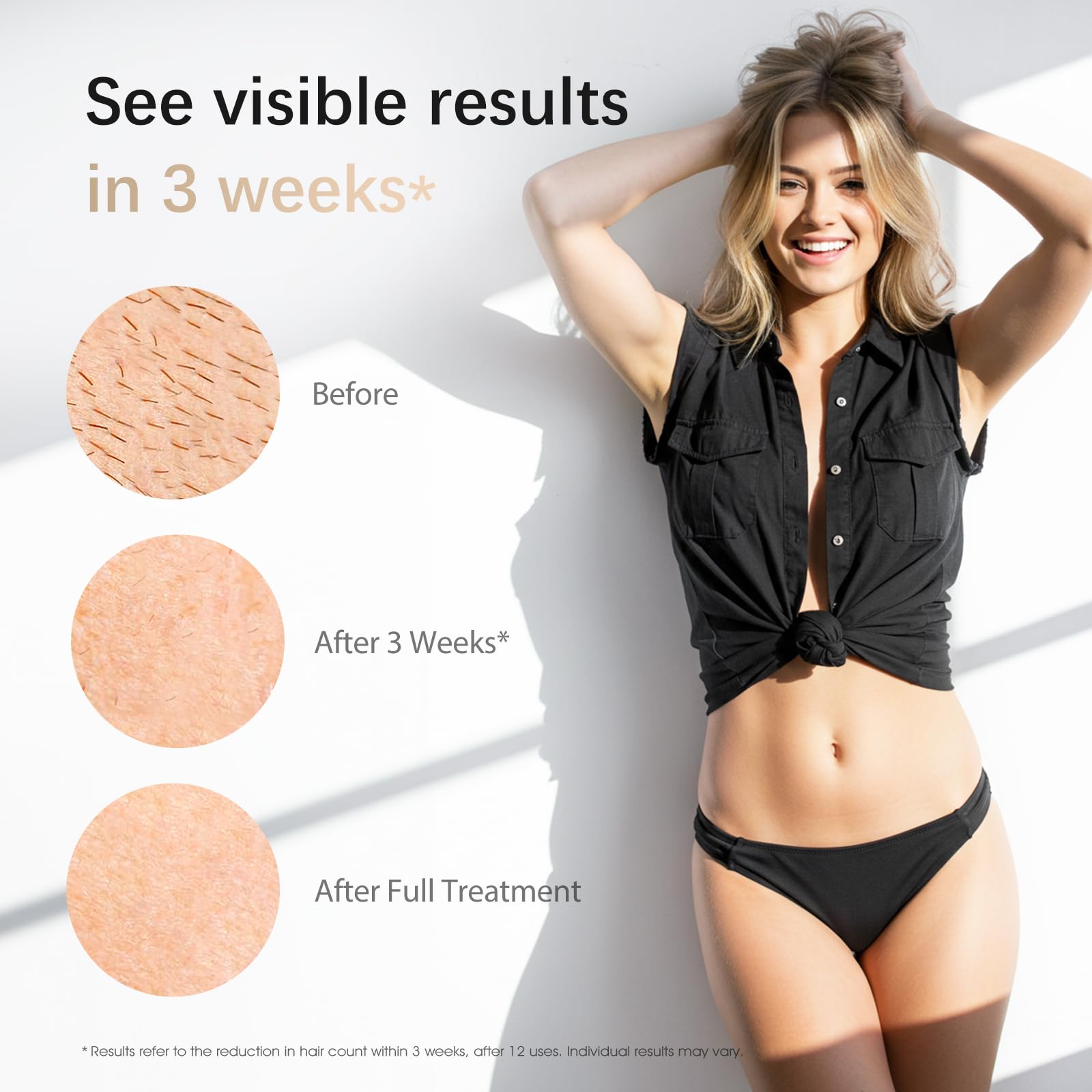 IPL Laser Hair Removal Device for Women & Men - Safe At-Home 45°F Ice-Cooling Contact for Painless & Long-Lasting Results, 86% Less Hair In 3 Weeks for Full Body & Face, White