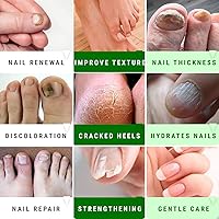 Vista 4 de Urea Nail Gel - Softens Cracked Heel Calluses & Thick Toenails - Repairs Damaged, Yellow, Discolored Nails – Highly Effective & Quick-Dry Urea Verde