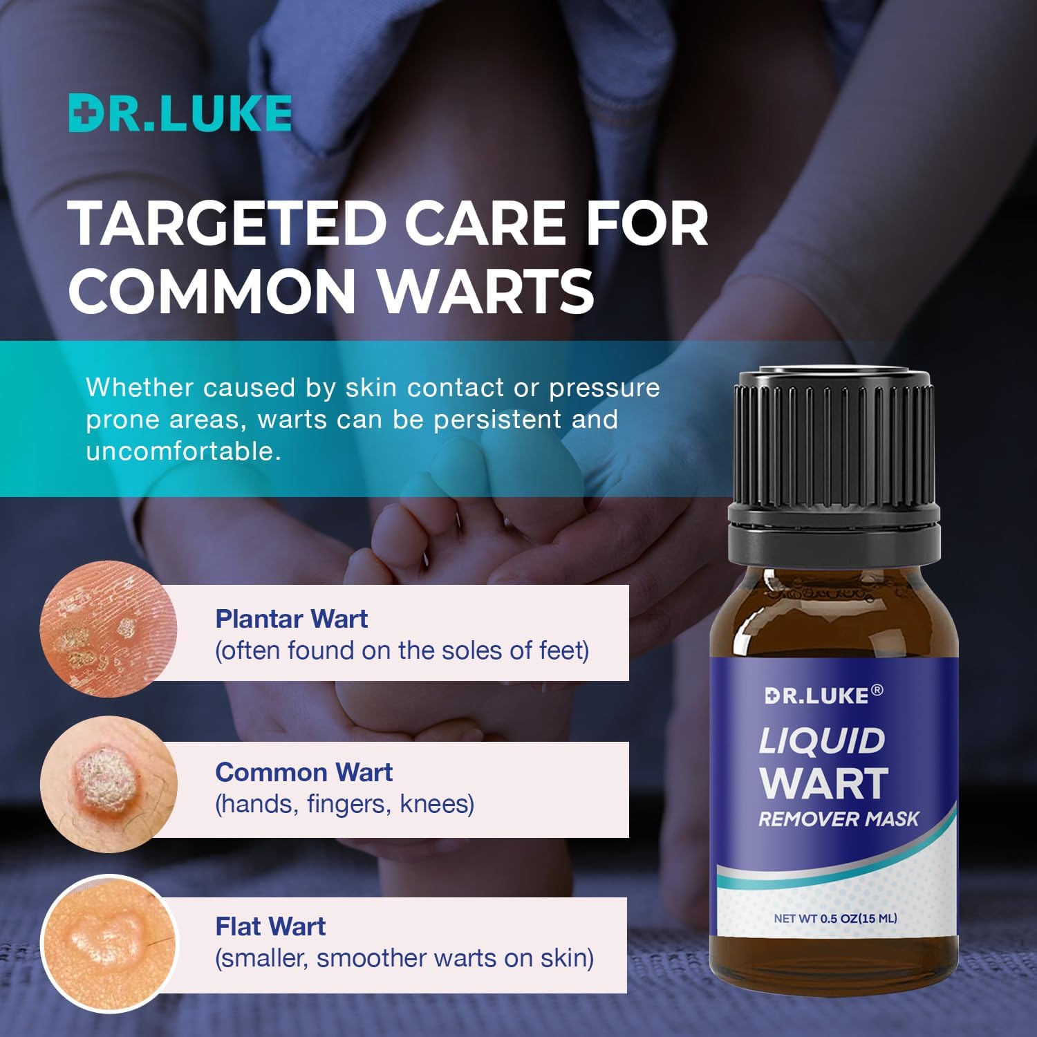 Liquid Wart Remover -image