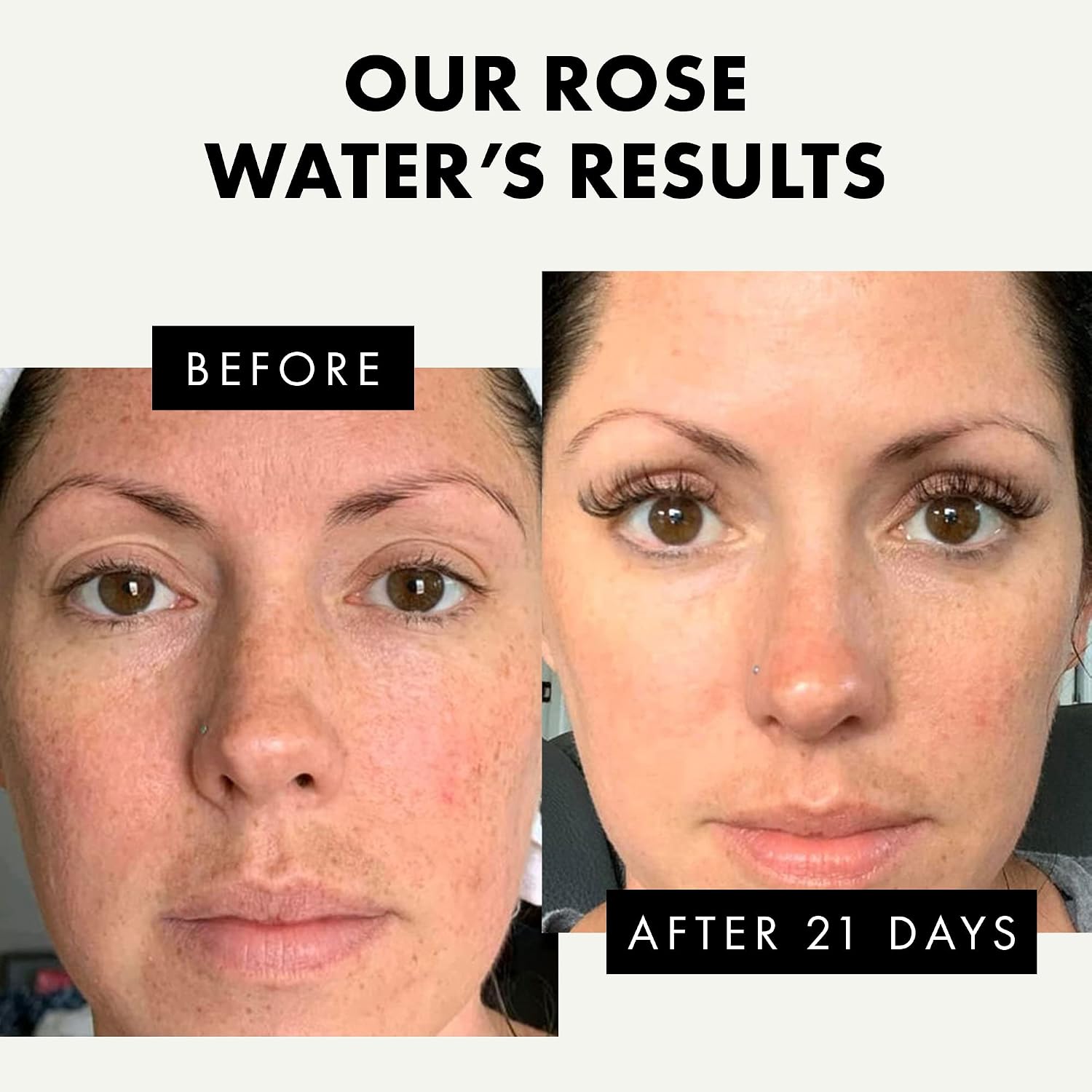 Eclat Skincare Rose Water Toner, Hydrating Toner for Face, Rosewater with Hyaluronic Acid & Aloe Vera - Image 4