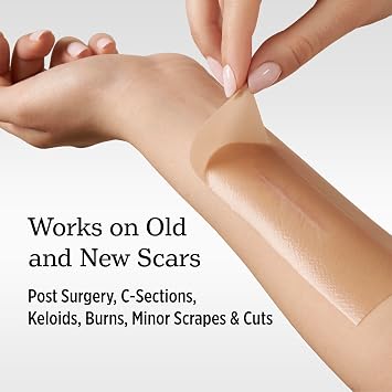 NUVADERMIS Silicone Scar Sheets - Extra Long Scar Sheets for C-Section, Tummy Tuck, Keloid, and Surgical Scars - Reusable Medical Grade Silicone Scar Sheets - Pack of 4 - Light Tone