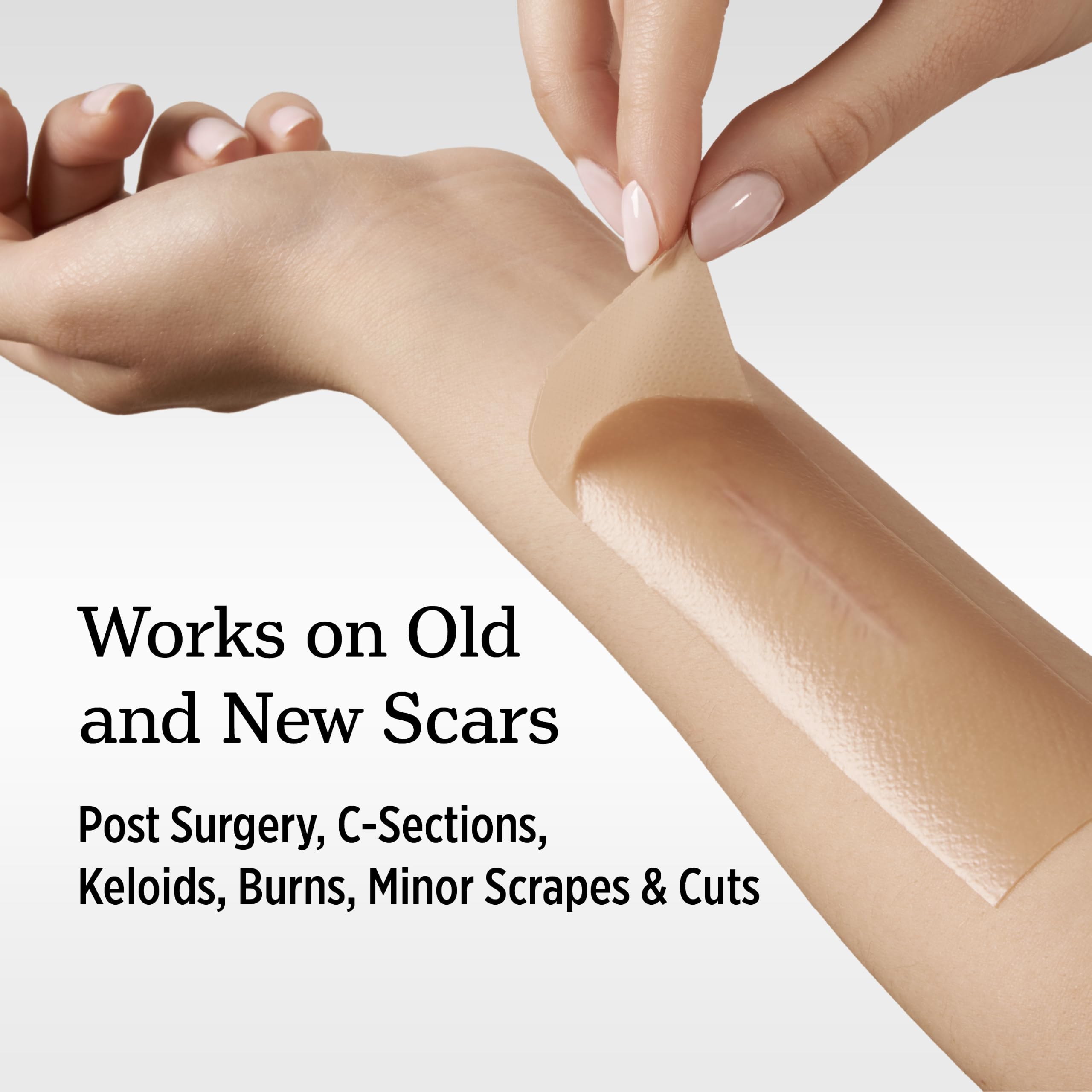 NUVADERMIS Silicone Scar Removal Sheets - Keloid, C Section, Post Surgery & Acne Scars Treatment-2 Month Supply - Silicon Soft Long Strips & Sheets 5.7" x 1.57" - Healing Alternative to Gel, Tape etc — Amazon image 3