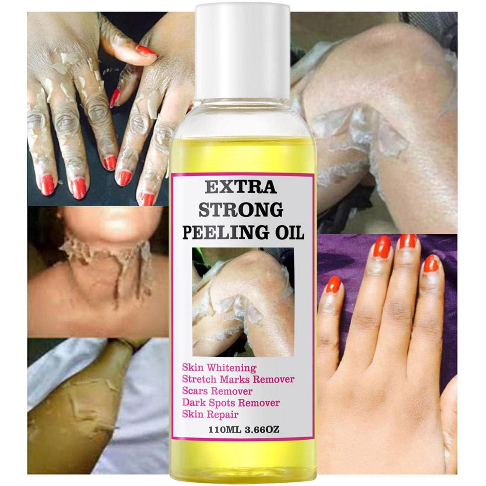 Exfoliating Oil for Face & Body - 16% Salicylic Acid Dead Skin Removal - Gentle Formula for All Skin Types - Hydrating Non-Irritating Treatment - 120mL (1Pack)