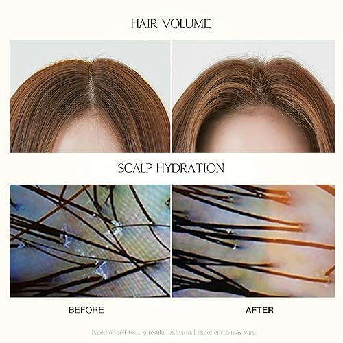 Miniatura 5 de Champú de humedad suave  Hidratante y nutritiva para cuero cabelludo normal a seco, dermatológicamente probado, libre de 12 ingredientes agresivos,