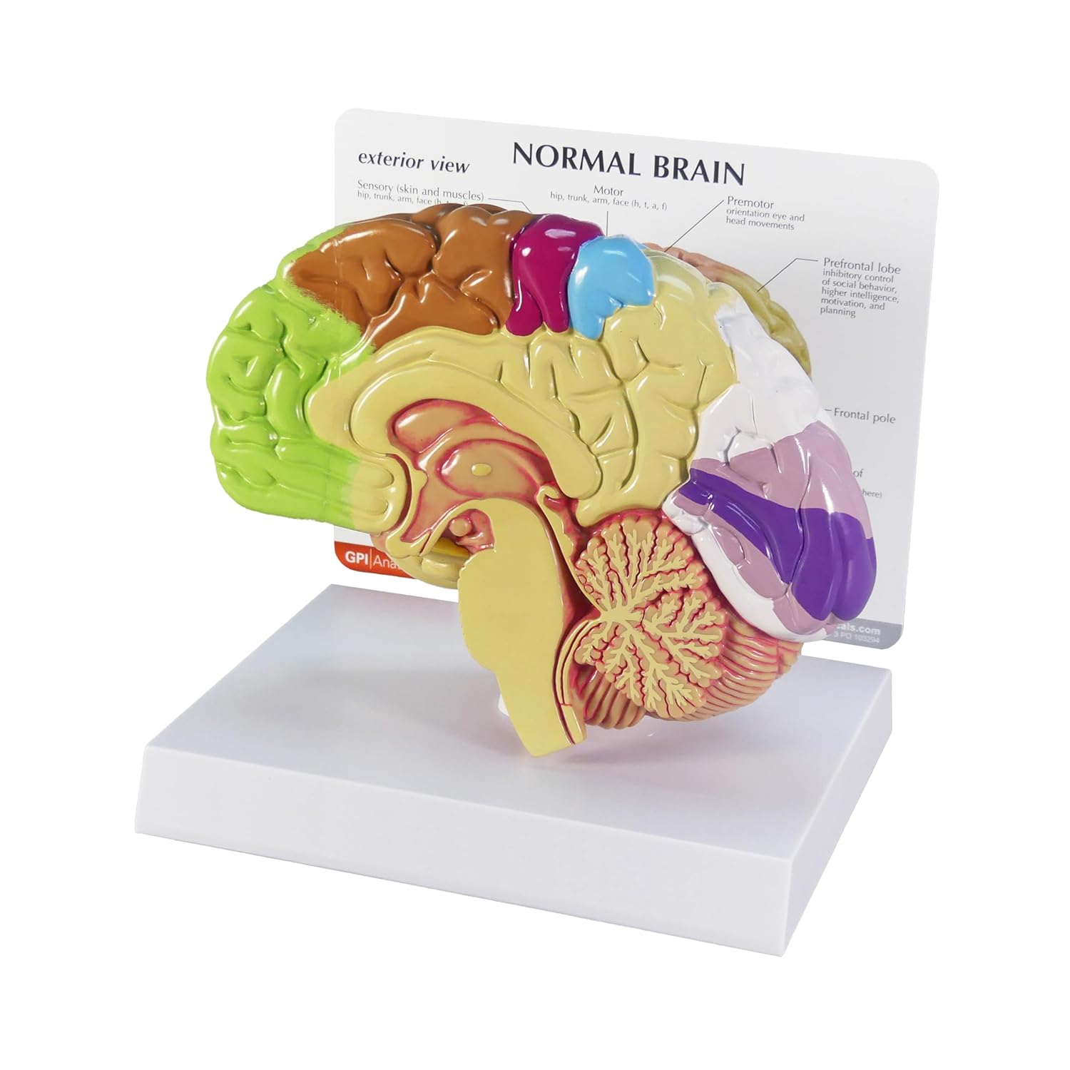 GPI Anatomicals - Brain Model, Replica of a Brain Inside a Partial Skull Afflicted by Pathologies for Human Anatomy, Physiology Education, Anatomy Model for Doctor's Office, Medical Learning Resources