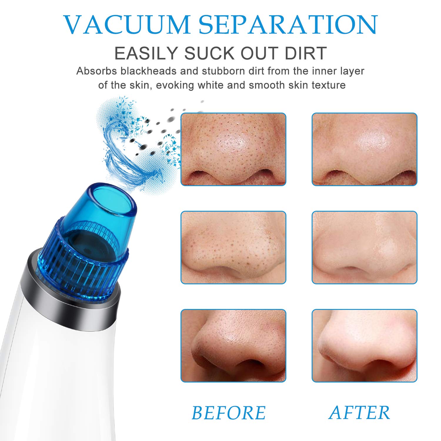 Blackhead Remover Pore Vacuum - JEXCULL Electric Blackhead Removal Tool Acne Extractor Facial Cleaner Suction Tools Kit for Women Men USB Rechargeable with 5 Suction Probes(Blue)