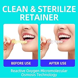 Retainer Cleaner Tablets,Denture Cleaning Tablets for Deep Remove Stains,Denture Cleaner Tablets 240 Tablets - Minty Fresh