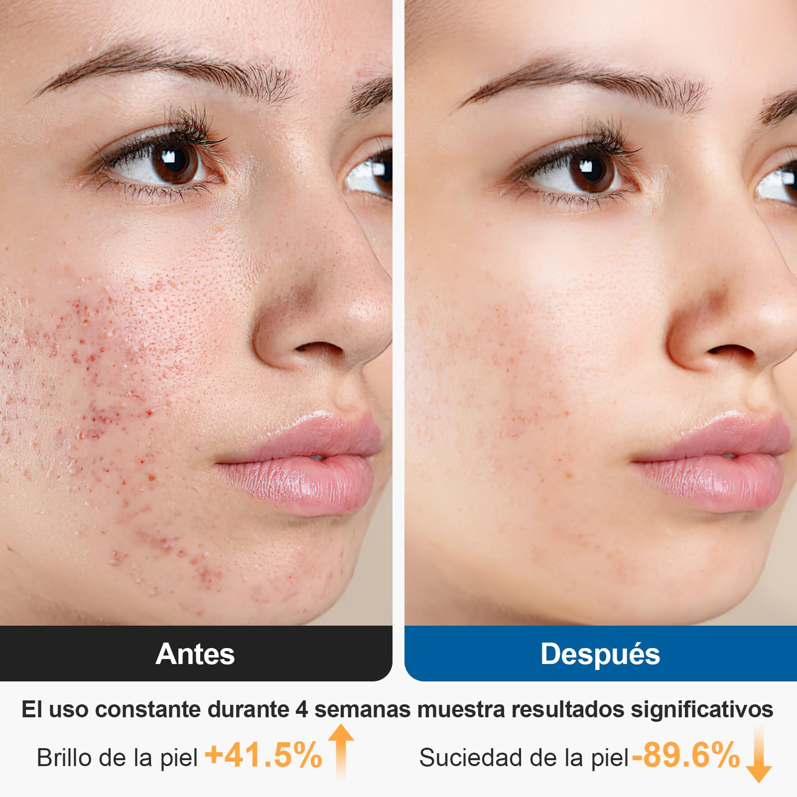 Cepillo facial eléctrico 2 en 1, IPX6, rosa | 4 cabezales, EMS+calor+vibración, 120 min, todos tipos de piel, ideal viaje