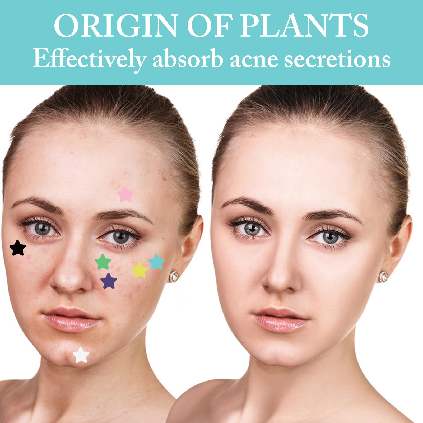 560Pcs Pimple Patches 14Sheets 7 Colors Acne Star Spot Patches Spot Stickers for Face Treatment Absorbing Cover Invisible for Fast Acting Skincare - Image 4