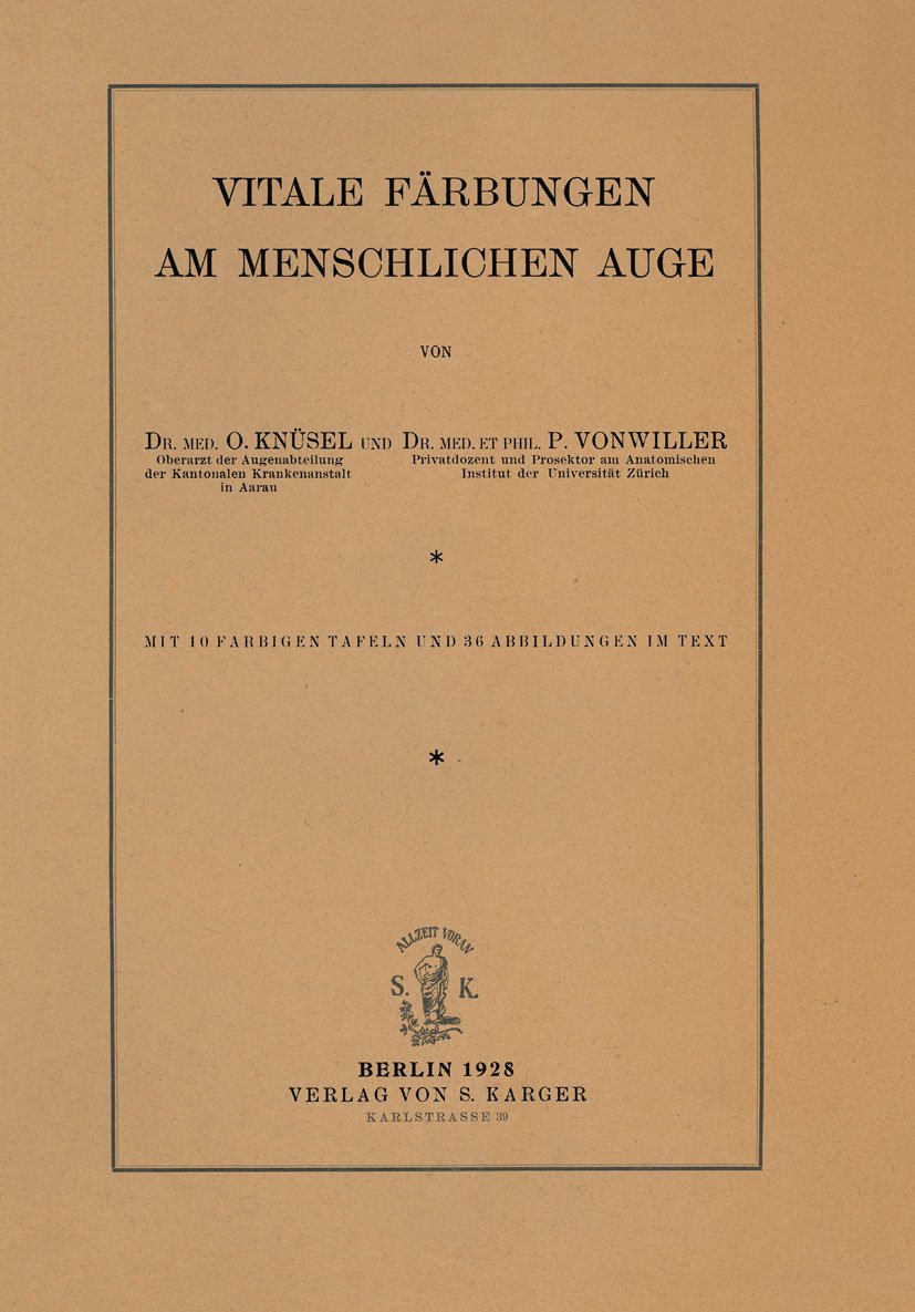 Vitale Färbungen am menschlichen Auge