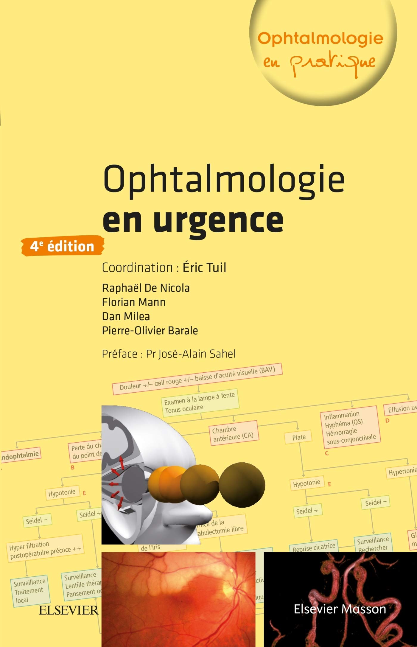 Ophtalmologie en urgence: Arcom 21/04/23