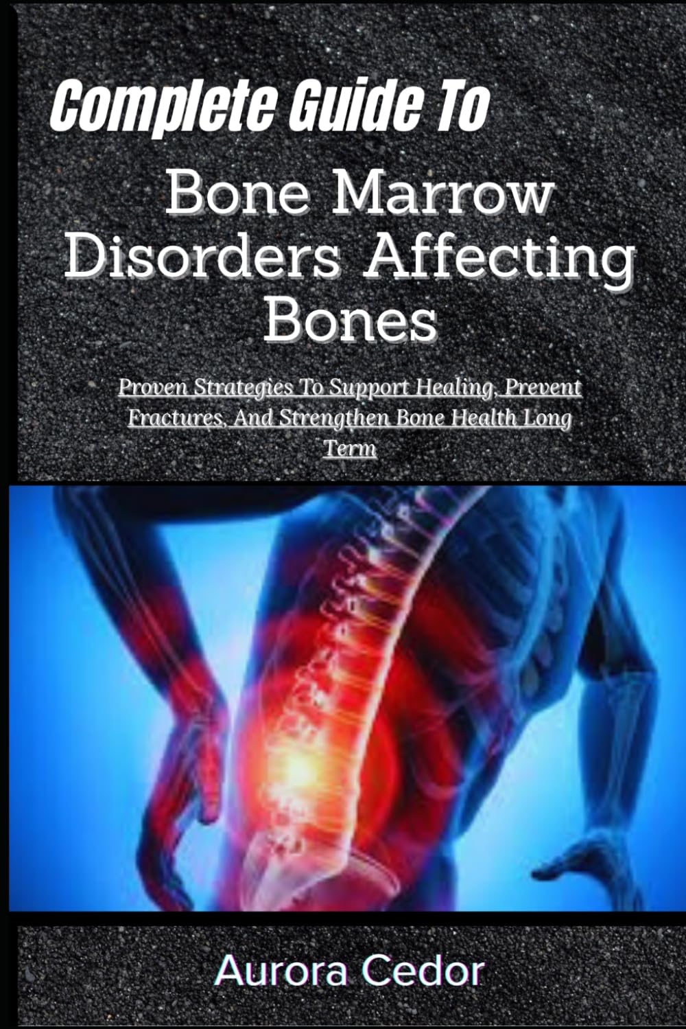 Complete Guide To Bone Marrow Disorders Affecting Bones: Proven Strategies To Support Healing, Prevent Fractures, And Strengthen Bone Health Long Term