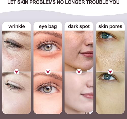 Miniatura 6 de MiSMON Máquinas faciales de alta frecuencia, 4 en 1 dispositivo facial de la fotontherapy de la luz de la microcorriente del Massager para la cara