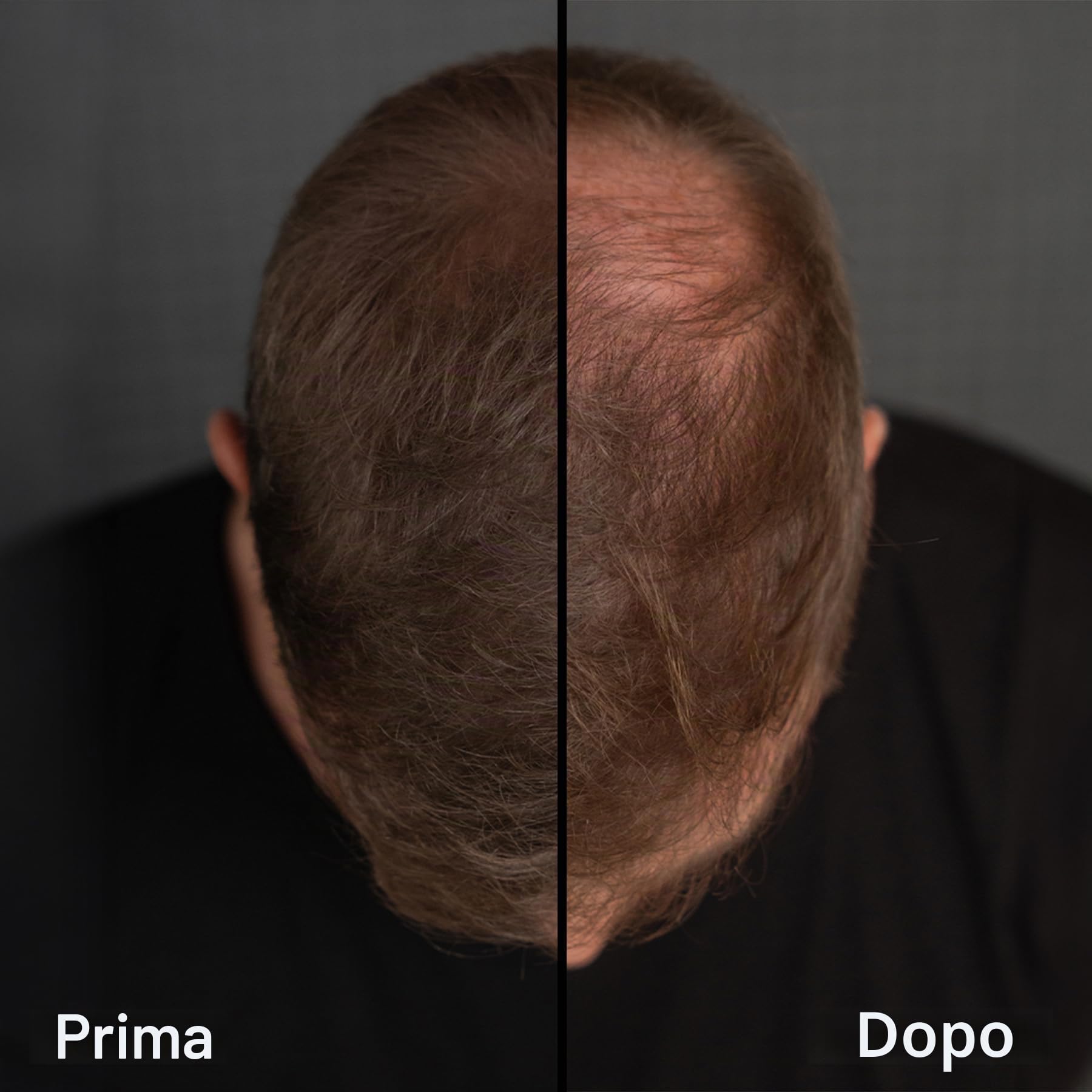 LEON MIGUEL Polvere di radice – Impermeabile Hairline Powder come perfetto correttore per capelli da attaccare, trucco invisibile per infoltire i capelli (biondo chiaro, Hairline Powder Pro)