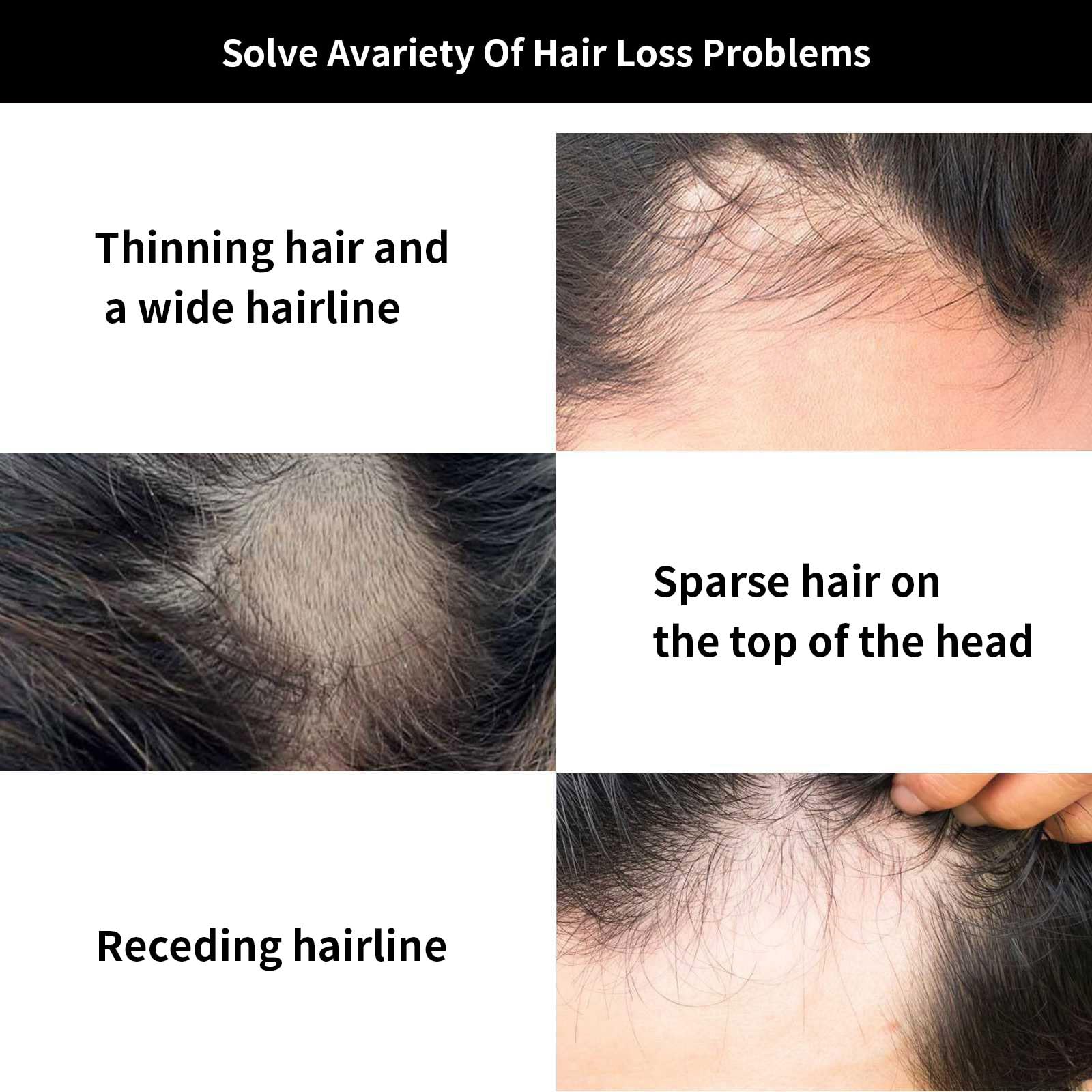 Minoxidil Hair Serum, Suitable for Both Men and Women, 5% Minoxidil Hair Growth, Resulting In Thicker, Stronger Hair. — view 6