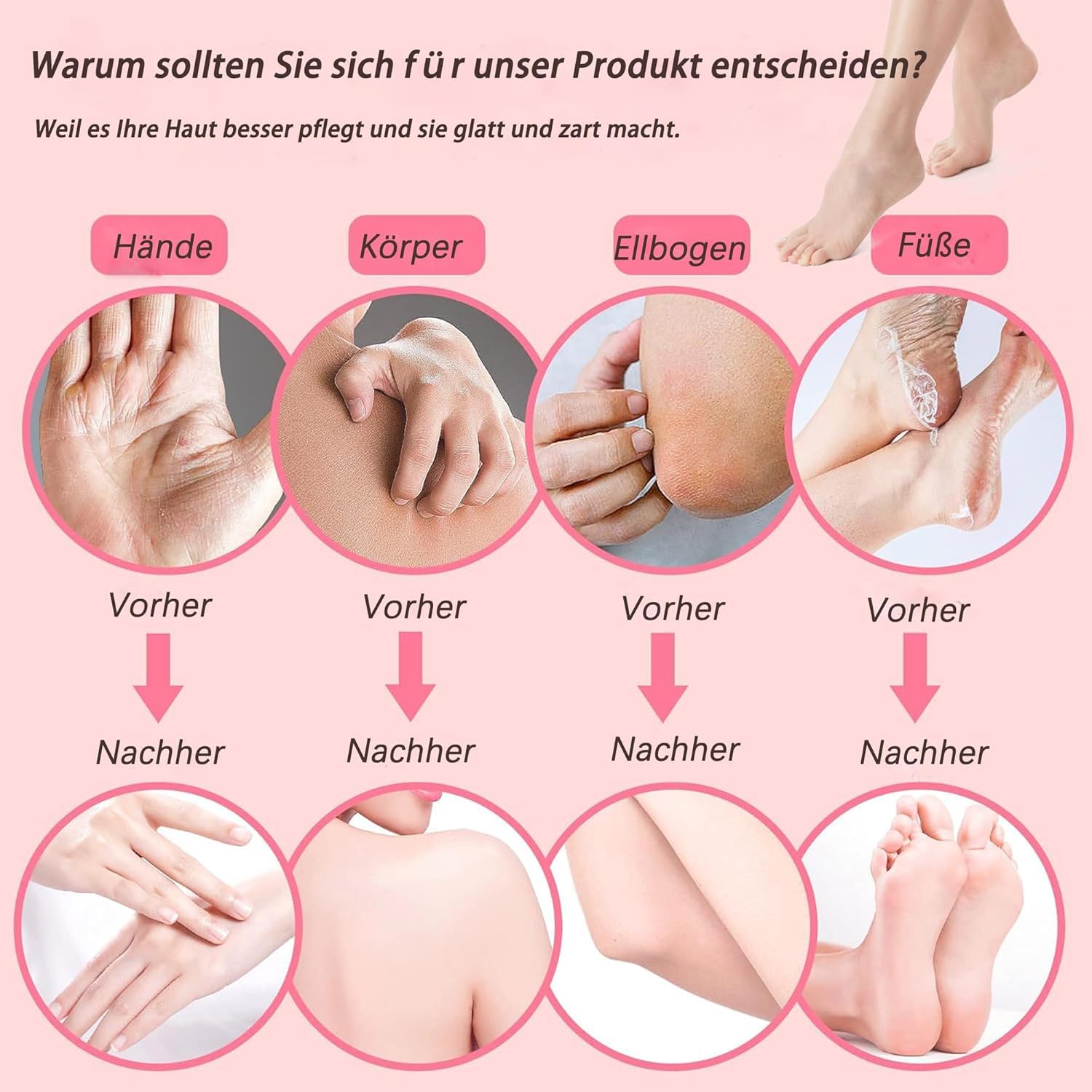 4L Paraffinbad für Hände und Füße mit Zubehör – Profi SPA Paraffin Wachsbad zur Hautbefeuchtung & Gelenkberuhigung, Ideal für Zuhause & Salon