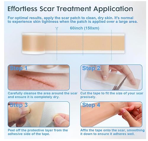 Miniatura 4 de Cinta de silicona para cicatrices, hojas de silicona de grado médico, 1.6 x 60 pulgadas, paquete de 2 unidades, tratamiento profesional de