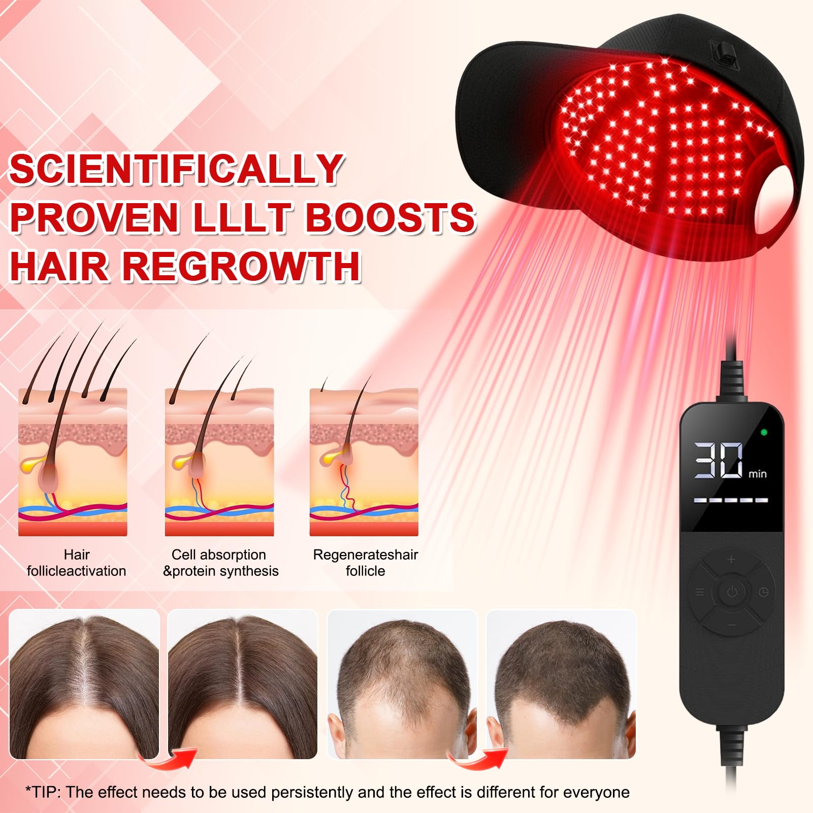 Cuffia LLLT per la cura dei capelli con luce rossa 660, 850 e 940 nm