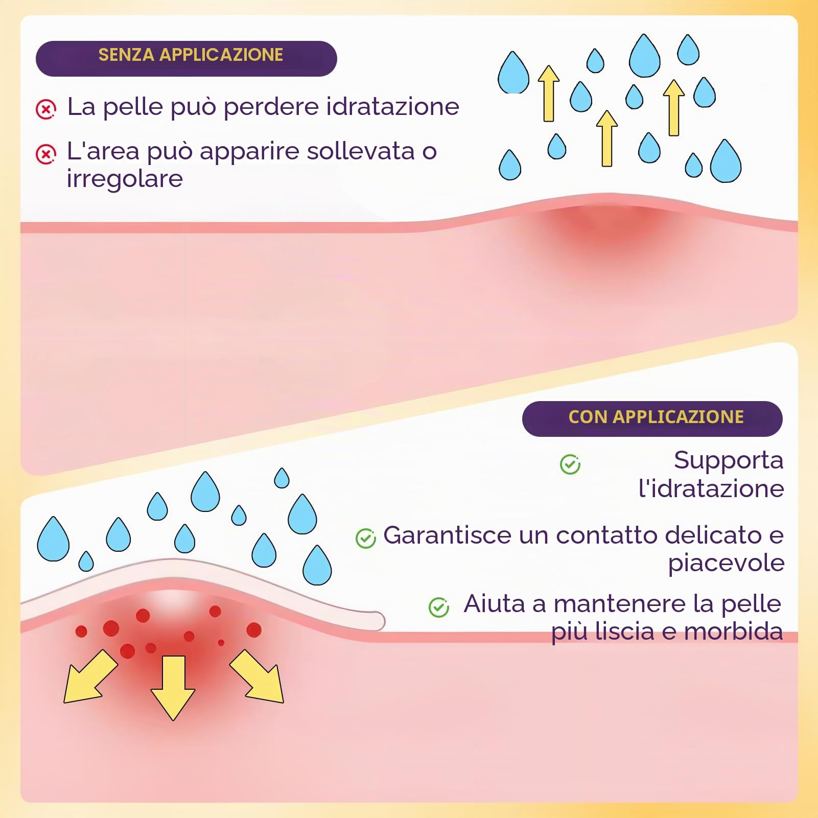 Cerotto per cicatrici in silicone, 4cm x 300 cm, riutilizzabile, color pelle, impermeabile, delicato sulla pelle e traspirante (1 Rotolo)