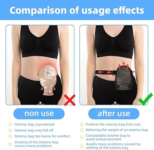 Miniatura 2 de Bolsa de ostomía impermeable con banda de fijación ajustable, reutilizable, universal, para estomía, suministros para ileostomía