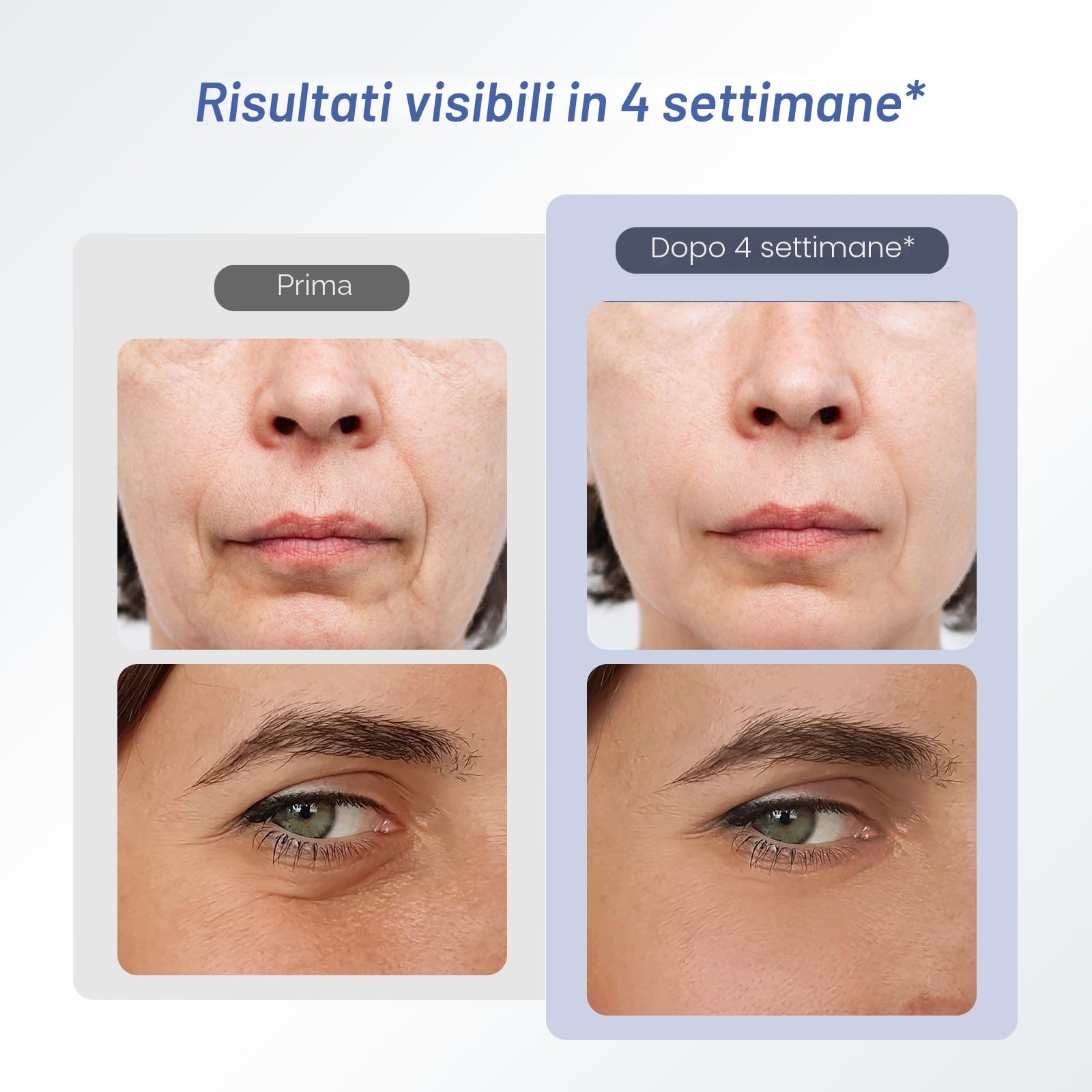 Radiofrequenza Viso e Corpo 2MHz, Massaggiatore Antirughe Viso Lifting con EMS 90kHz, Dispositivo Anti-Età (Blu)