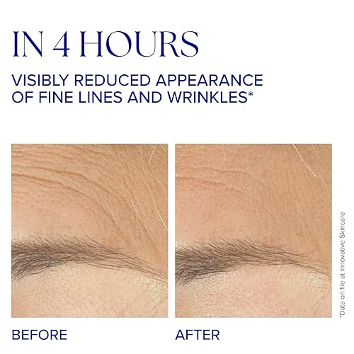 Miniatura 3 de IS CLINICAL Complejo juvenil, una fórmula antienvejecimiento, aumenta la producción de colágeno y elastina antiarrugas y reafirma la piel