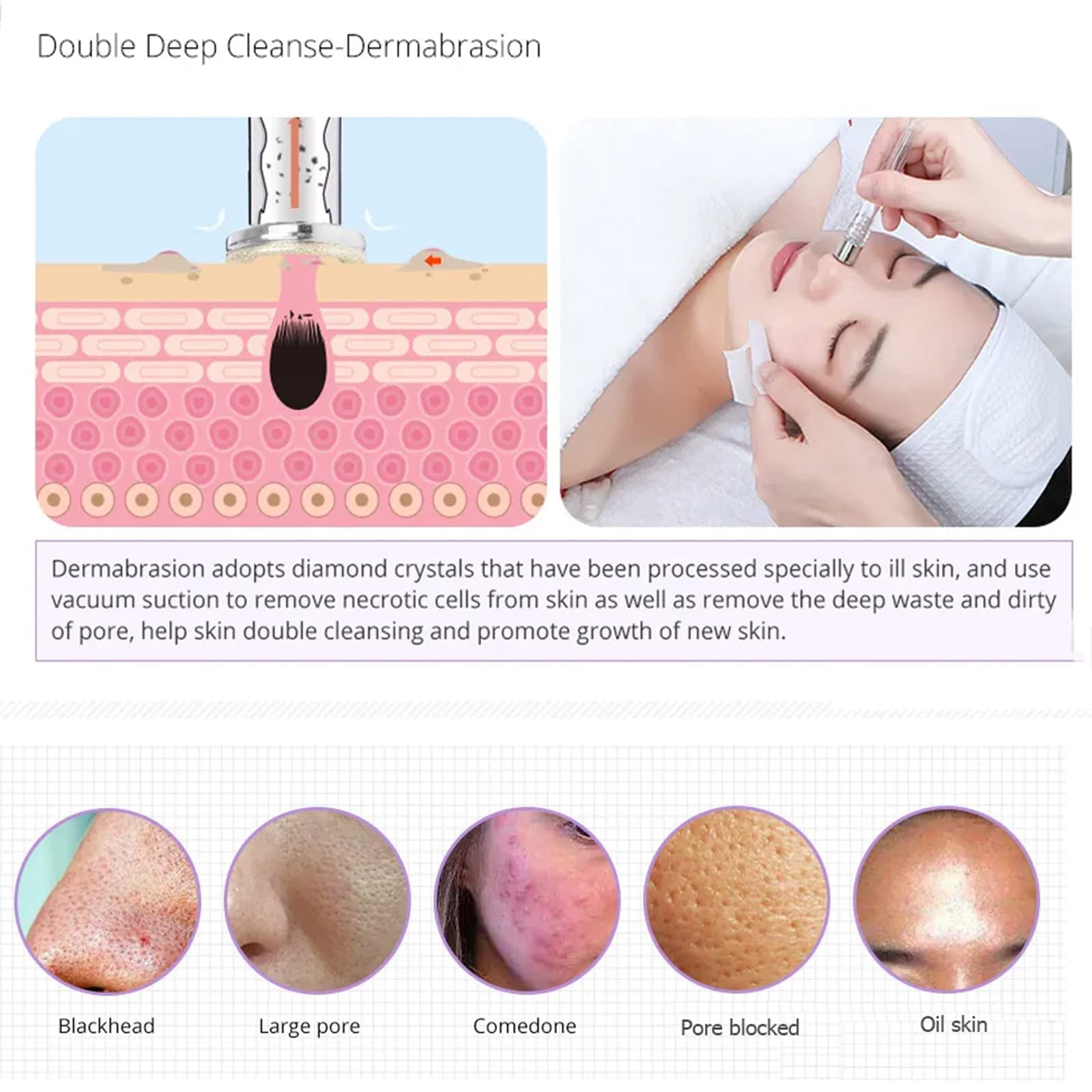 Máquina facial profesional 5 en 1: microdermoabrasión y terapia de iones galvánicos para limpieza profunda, absorción de suero antienvejecimiento, levantamiento de RF y rejuvenecimiento de la piel LED