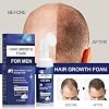 Hair Regrowth Foam for Men,Treatment for Men Growth Serum,Hair Regrowth Spray Foam Growth,60g
