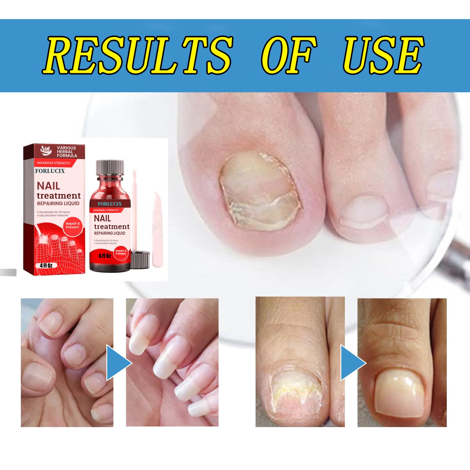 Extra Strength,4 Fl Oz(Pack of 1),Red