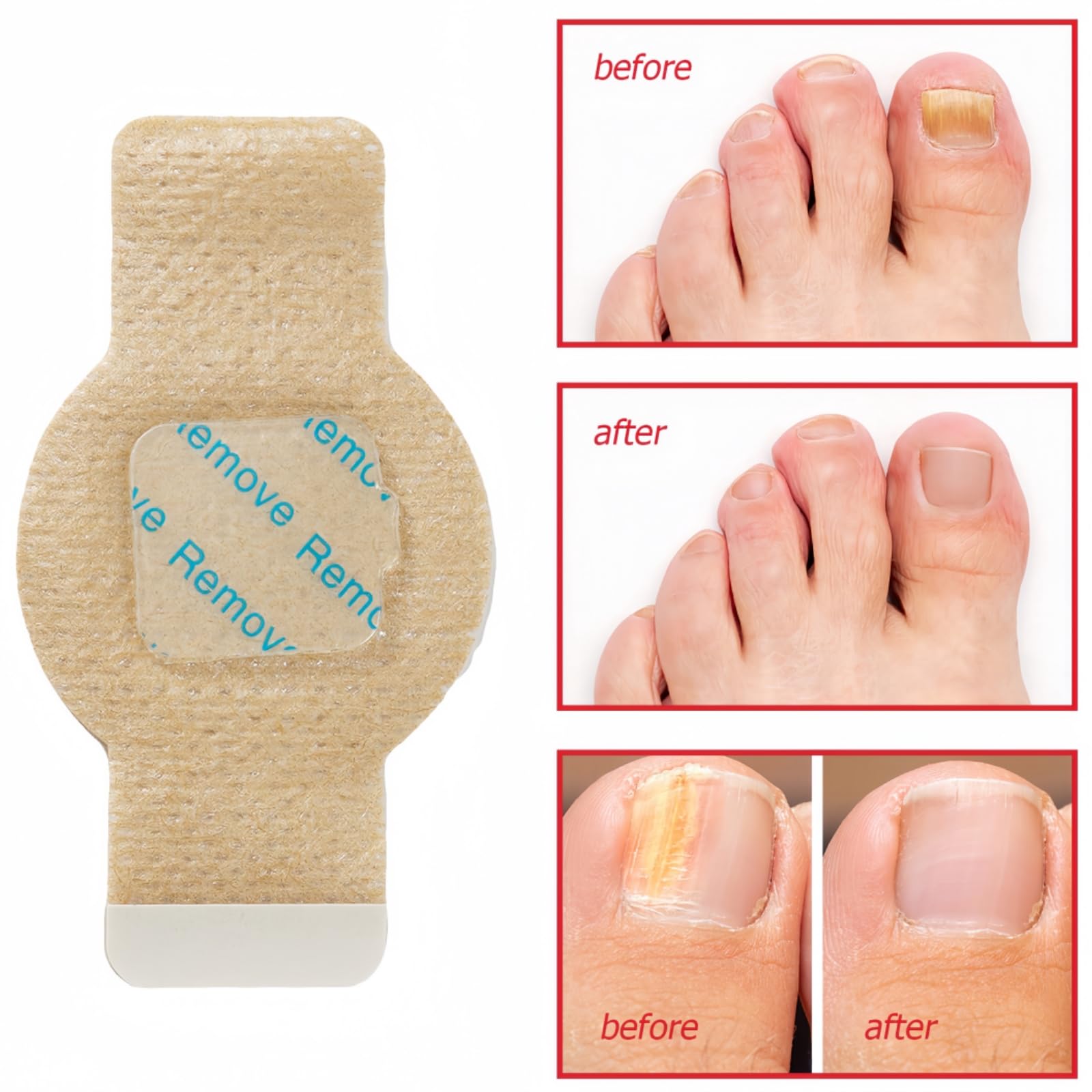 21 Pcs Fungal Nail Treatment Patches, Toenail Repair Pads for Targeted Relief, Antifungal Nail Treatment for Toenails - Image 2