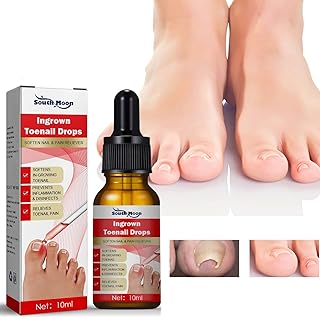 Ingrown Toenail Treatment,Nail Helper,Nail Growth Treatment,Ingrown Toenail Drops,Cuticle Nail Oil,Ingrown Toenail Correction,Fungal Nail Treatment for Toenails, Extra Strong for Damaged Nails